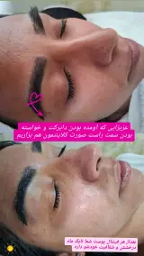 خدمات مراقبت پوست ونوس