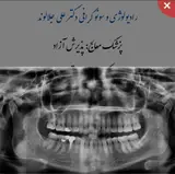 رادیولوژی وسونوگرافی طلایی