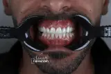 دکتر فرشته احمدی دندانپزشک(بیمه نداریم)