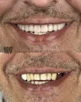 مطب دندانپزشکی دکتر پدرام عبداله زاده