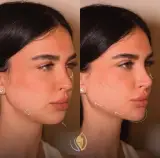 مرکز لیزر مهرآسا