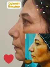 جراح و متخصص گوش حلق و بینی دکتر قرشی