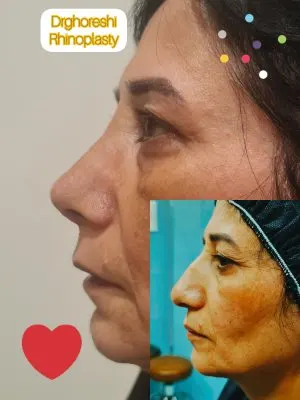 جراح و متخصص گوش حلق و بینی دکتر قرشی