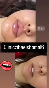 كلينيك زيبايی شمال با مشاوره عقبايی