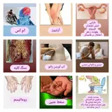 درمانگر طب سنتی خانم بلوچ