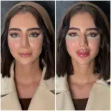 مجموعه لیزر و زیبایی کارنا(شاتی نداریم)