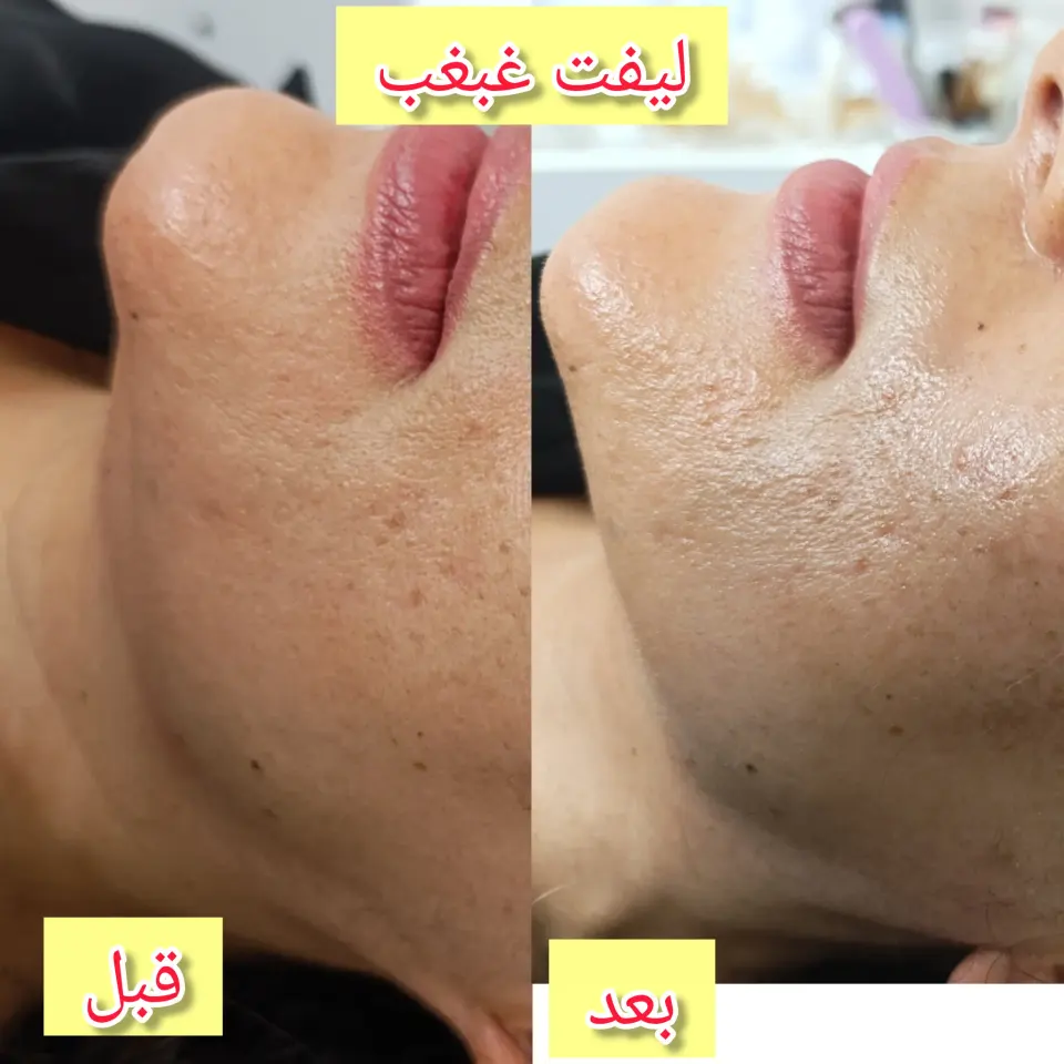 فیشیال مدیکا الیت