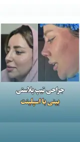 جراح بینی دکتر نادرنظری