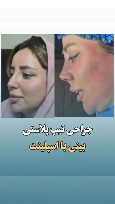 جراح بینی دکتر نادرنظری