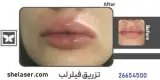کلینیک زیبایی و لیزر پارادایس