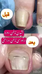 پدیکور و پدولوژیست فرزانه محمدی