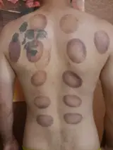 اسپرت ماساژ