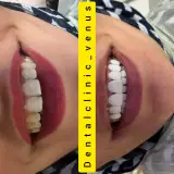 کلینیک دندانپزشکی ونوس (شعبه پیروزی)