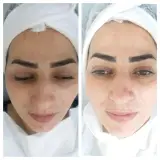 آموزش و خدمات فیشیال تخصصی