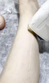 مرکز لیزر و پاکسازی پوست سحر