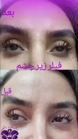 مطب پوست ،مو زیبایی دکتر فاطمه قره داغی
