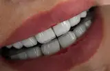 کلینیک تخصصی دندانپزشکی آلفا(بیمه داریم)