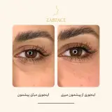 کلینیک تزریق فیلر و بوتاکس زرفیس