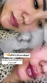 مطب زیبایی خانم محمدرضایی پوست ومو
