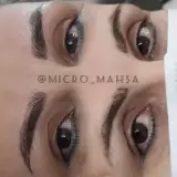 Micro_mahsa میکروبلیدینگ فیبروز