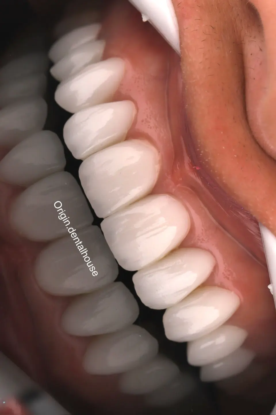 managed-by-sync_ad_images:imp-bc8faa4e98c726cb80bb