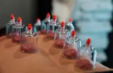 مرکز حجامت طب سنتی دکتر قاسم عقیلی بهنام