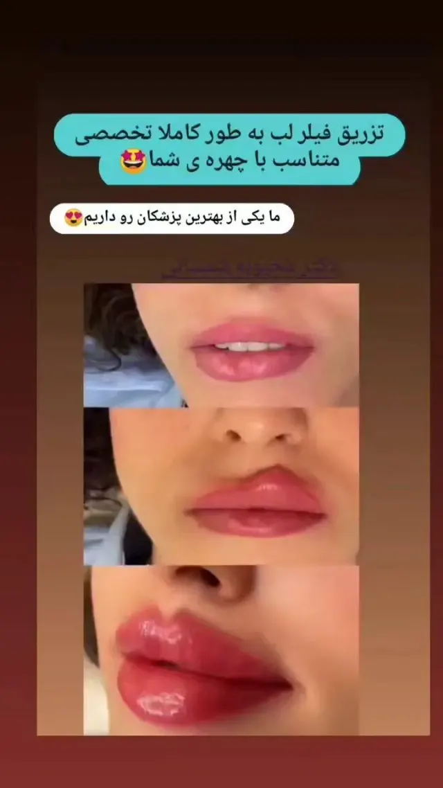 کلینیک زیبایی، پوست ،مو و لیزر مهرینا