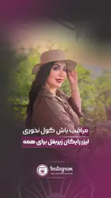 ليزر صدف
