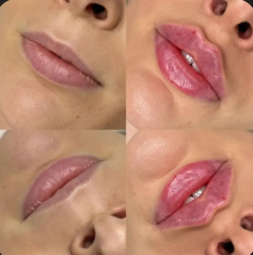 managed-by-sync_ad_images:imp-88db1a7583eeebd55a7a