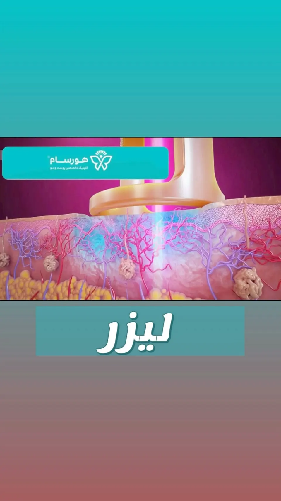 کلینیک پوست و مو هورسام