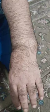 شکسته بندی و اورتوپدی سلمانی
