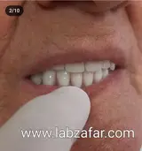دندانسازی ظفر