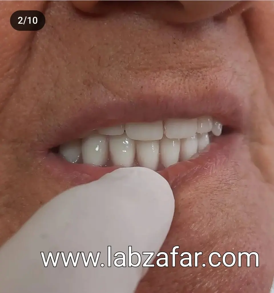 دندانسازی ظفر