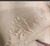 فیشال پوست اعتمادی