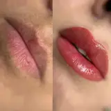 مرکزتخصصی ارایش دائم وریموو سپیده جلالی