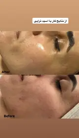 کلینیک فیشال و پاکسازی پوست سارن اسکین