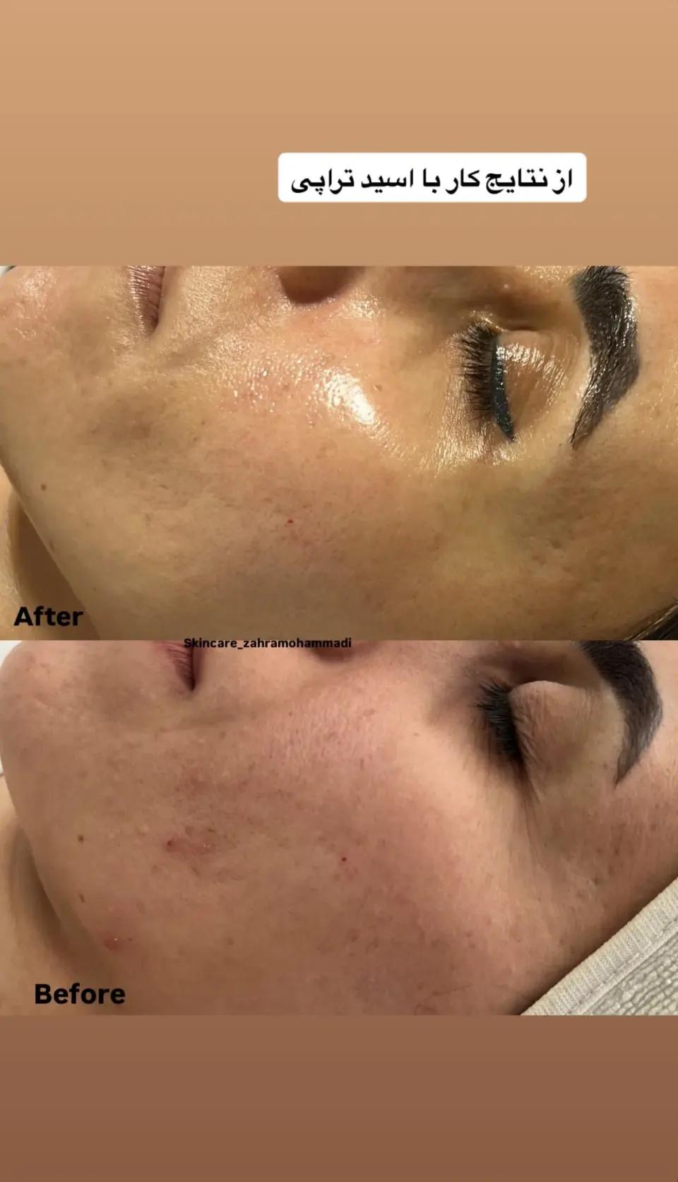 کلینیک فیشال و پاکسازی پوست سارن اسکین