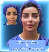 دکتر محمود قهقایی فوق تخصص جراحی پلاستیک