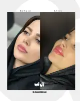 مرکز لیزر و پوست و مو گالریا