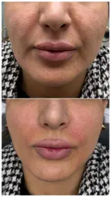 کیلینیک زیبایی دکتر رفیعی دکتر رحمانیان