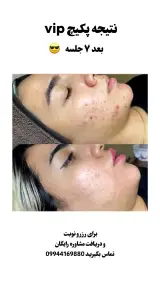 کلینک فیشال و پاکسازی پوست و ماساژ حانی