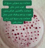 حجامت تخصصی کل بدن اکبرکریمی(سیار)