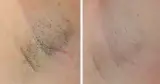 کلینیک لیزر و زیبایی یگانه