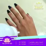 مرکز لیزر و زیبایی نیلوفر آبی رودهن