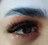 کاشت مژه