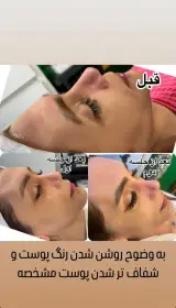 مرکز لیزر وکلینیک زیبایی پایون(بانوان)
