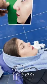 جراح بینی دکتر فرزاد رضایی