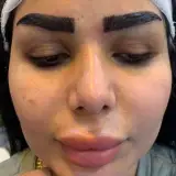 کلینیک کاشت ابرو رویال