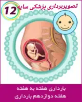 تصویربرداری سونوگرافی سیتی اسکن سایه