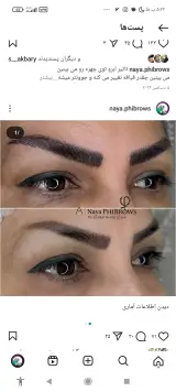 فیبروز تخصصی و حرفه ای نایا